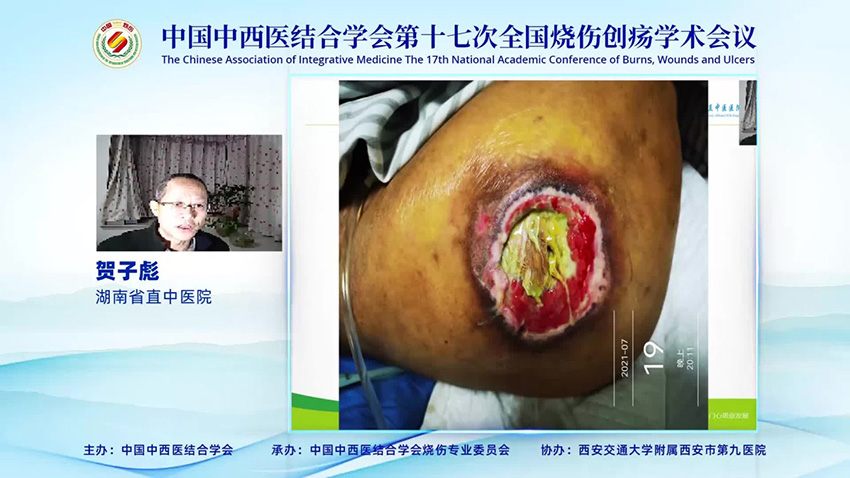 新宝GG—创立事业平台