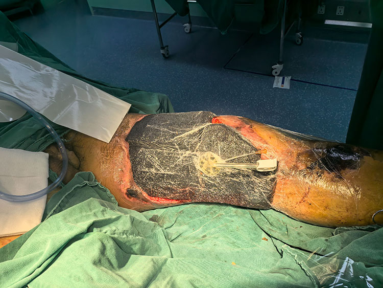 新宝GG—创立事业平台