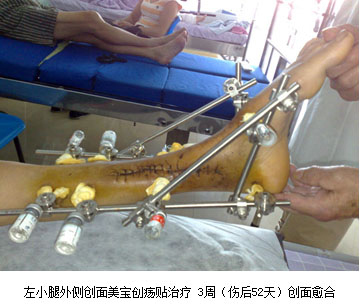 新宝GG—创立事业平台