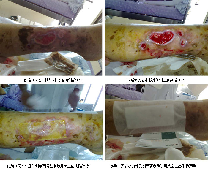 新宝GG—创立事业平台